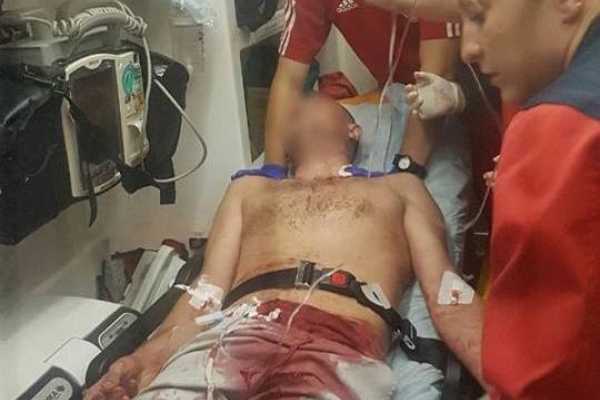 Кривава різанина на Франківщині: 15-річний жебрак порізав туриста за відмову надати милостиню (Відео)