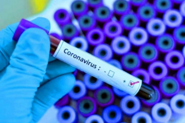 Троє нових хворих на коронавірус франківців контактували з померлою жінкою