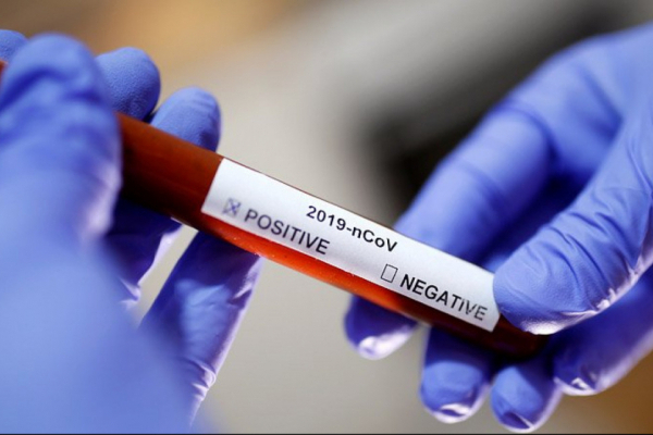 На Прикарпатті знову спалах коронавірусу у пологовому (Відео)