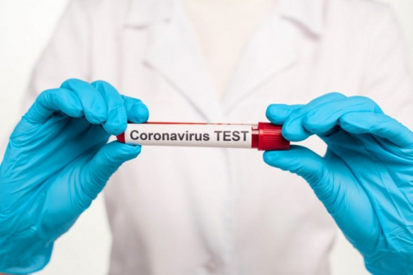 Коронавірус на Франківщині: виявлено 189 нових випадків