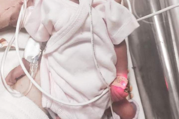 Медики із Рогатина виходили новонароджену дівчинку з вагою 775 грамів