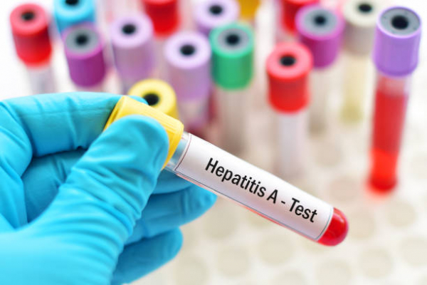 Гепатит A в Івано-Франківську: зареєстрували 12 випадкiв захворювання в жовтні